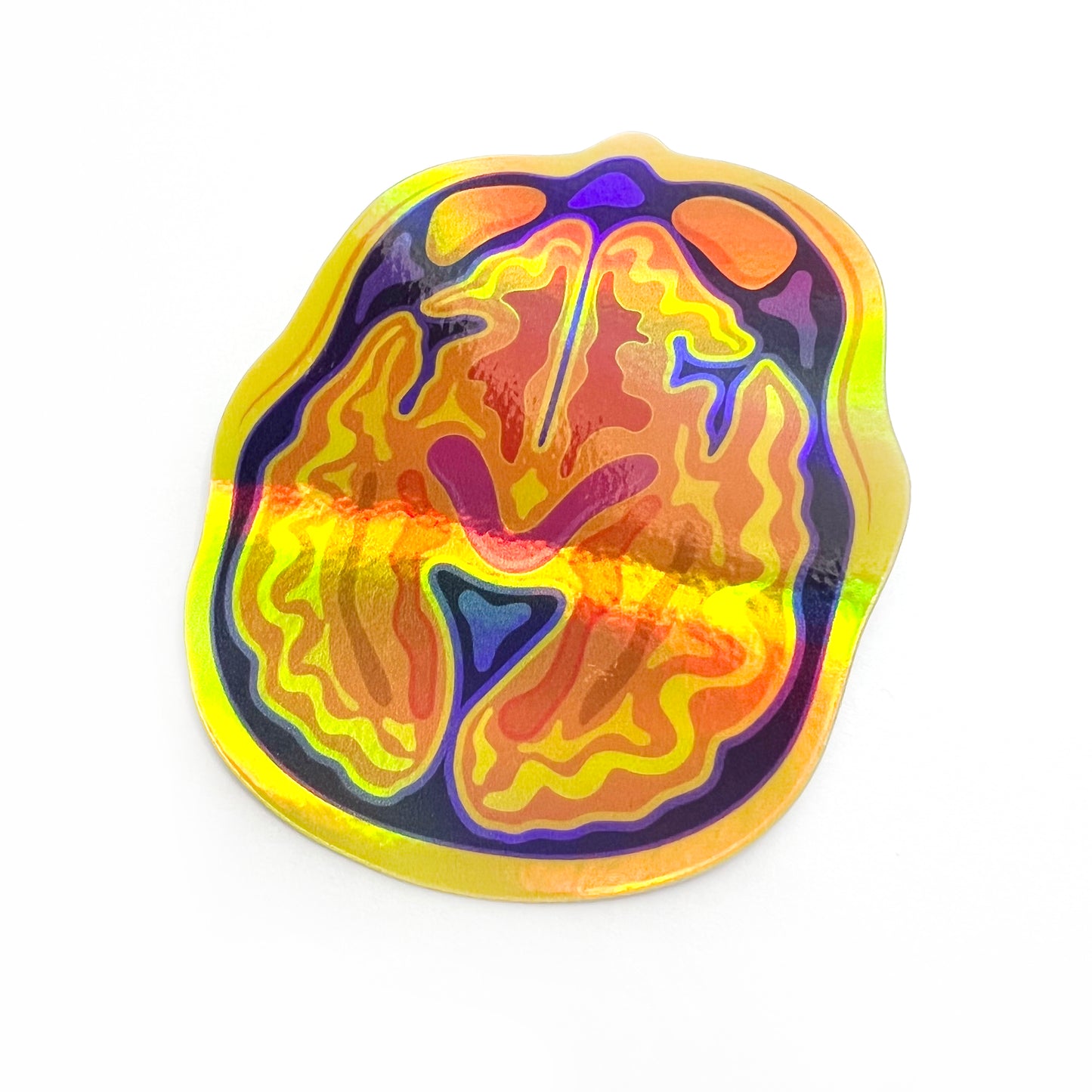 Holographic Brain MRI/CT Sticker